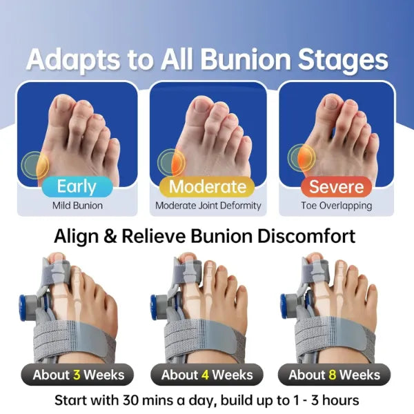 BunioFit Bunion Correctors AU2
